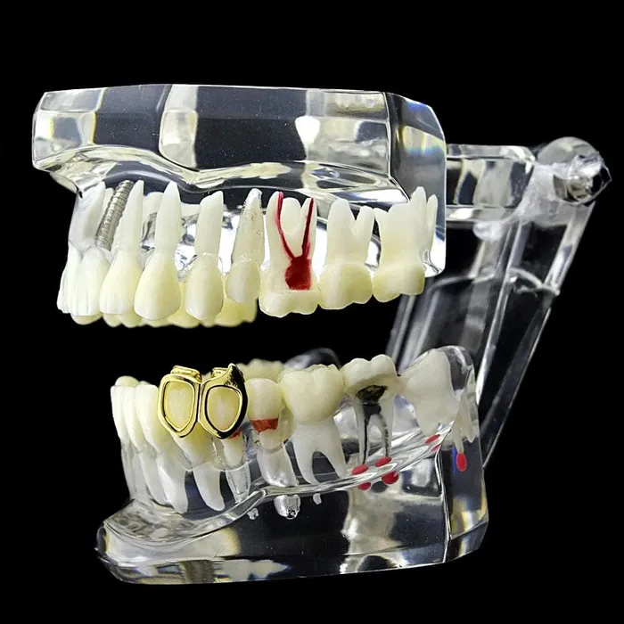 Bling Cartel Admin 14K Gold Plated Double Left Lower Gold Fang PreStyled Sets