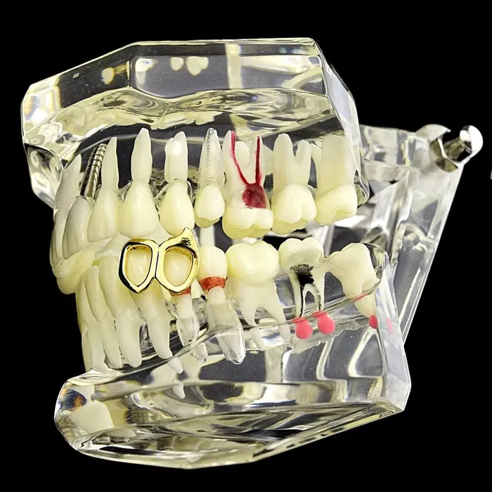 Bling Cartel Admin 14K Gold Plated Double Left Lower Gold Fang PreStyled Sets