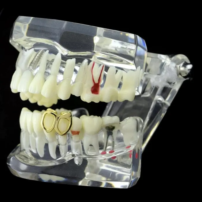 Bling Cartel Admin 14K Gold Plated Double Left Lower Gold Fang PreStyled Sets